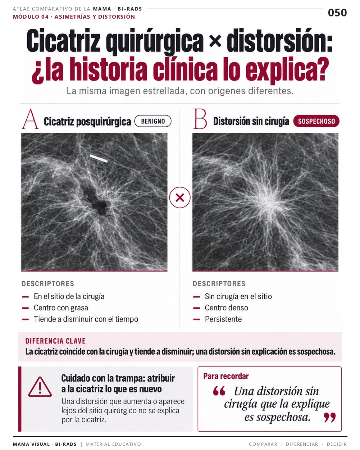 Página 50: Cicatriz quirúrgica × distorsión. Vista previa del PDF Mama Visual BI-RADS; imágenes didácticas simuladas.