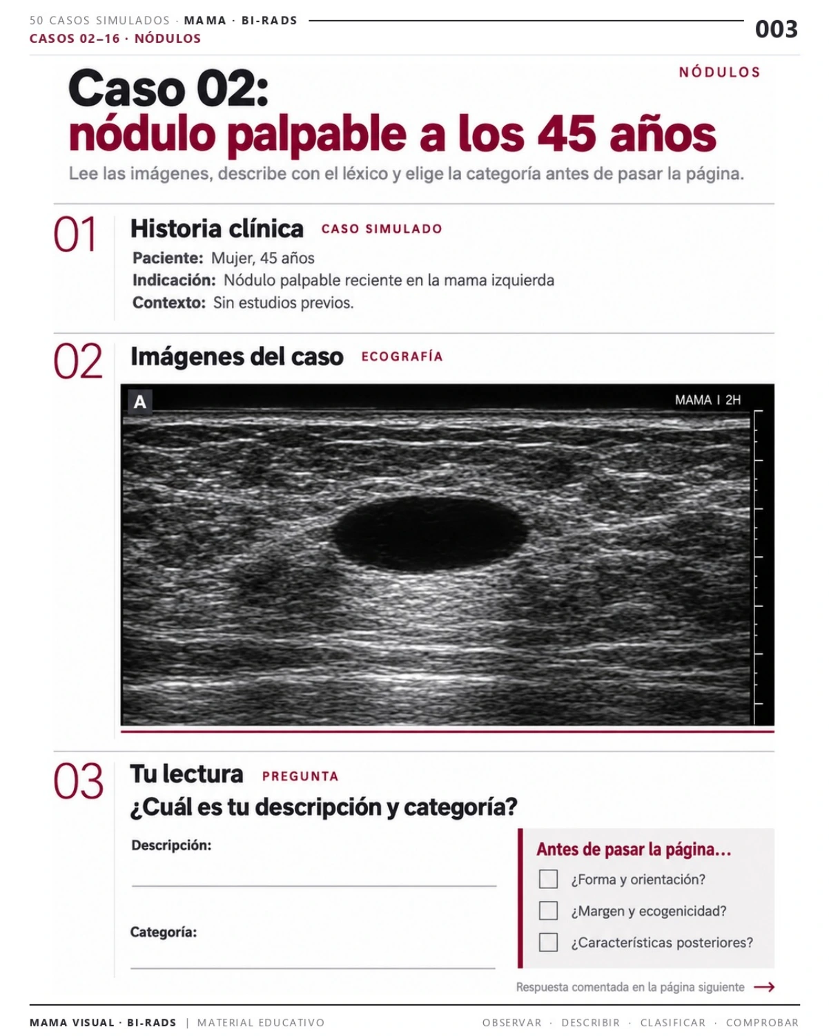 Página 3: Caso 02: nódulo palpable a los 45 años. Vista previa del PDF Mama Visual BI-RADS; imágenes didácticas simuladas.