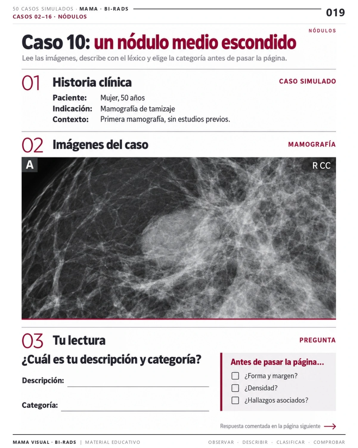 Página 19: Caso 10: un nódulo parcialmente oculto. Vista previa del PDF Mama Visual BI-RADS; imágenes didácticas simuladas.
