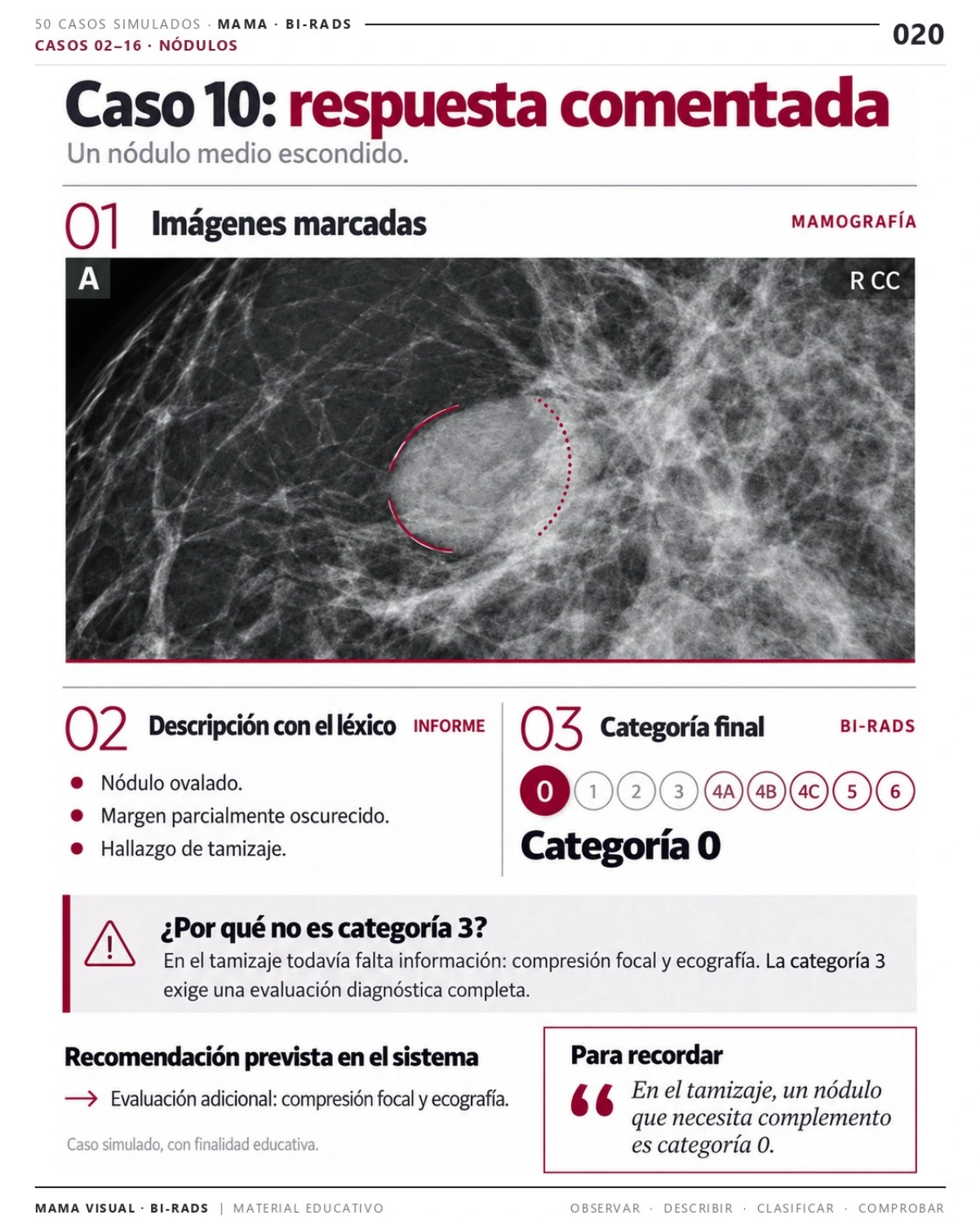 Página 20: Caso 10: respuesta comentada. Vista previa del PDF Mama Visual BI-RADS; imágenes didácticas simuladas.